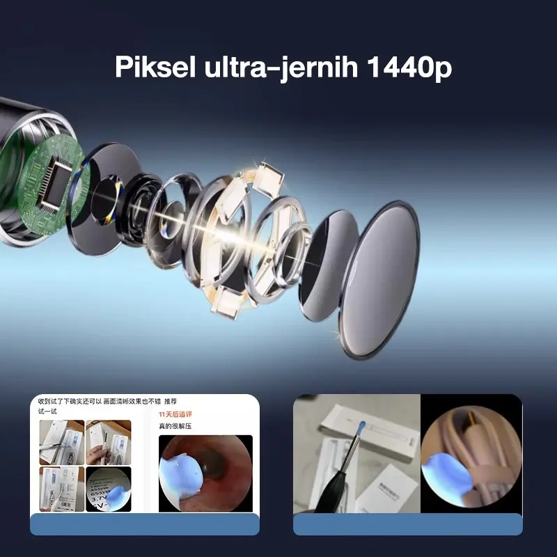 【Garansi 10 tahun】Korek kuping led Pembersih Telinga bayi alat pembersih telinga WIFI ear wax 5 in 1 Stainless steel besi earwax Senter  Dapat dihubungkan ke ponsel 3