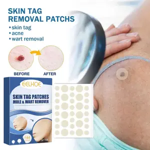 144pcs Stiker Penghilang Kutil Tahi Lalat Wart Removal Patch Skin Tag Wart Remover Patch Obat Kutil Paling Ampuh/Tahi Lalat Di Wajah Menghilangkan Kutil Tahi Lalat Mata Ikan