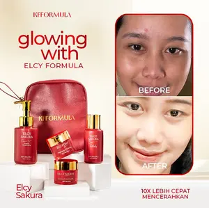 ECER ELCY SAKURA UNTUK KULIT SUSAH CERAH DAN FLEK