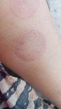 Product Review of Obat Kurap 19 Cair Bisa COD ORIGINAL from h**i 0