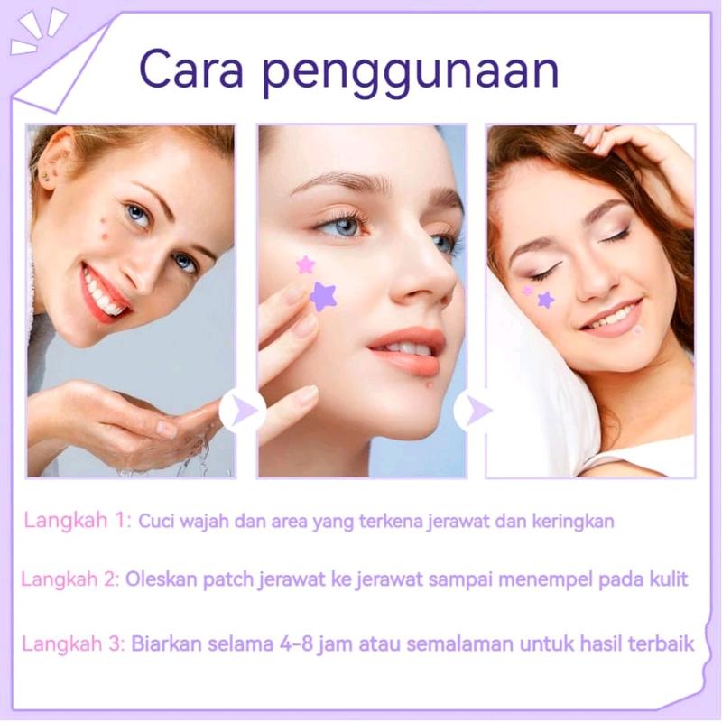 STIKER ACNE PATCH | PIMPLE PATCH | STIKER JERAWAT STAR LOVE 2