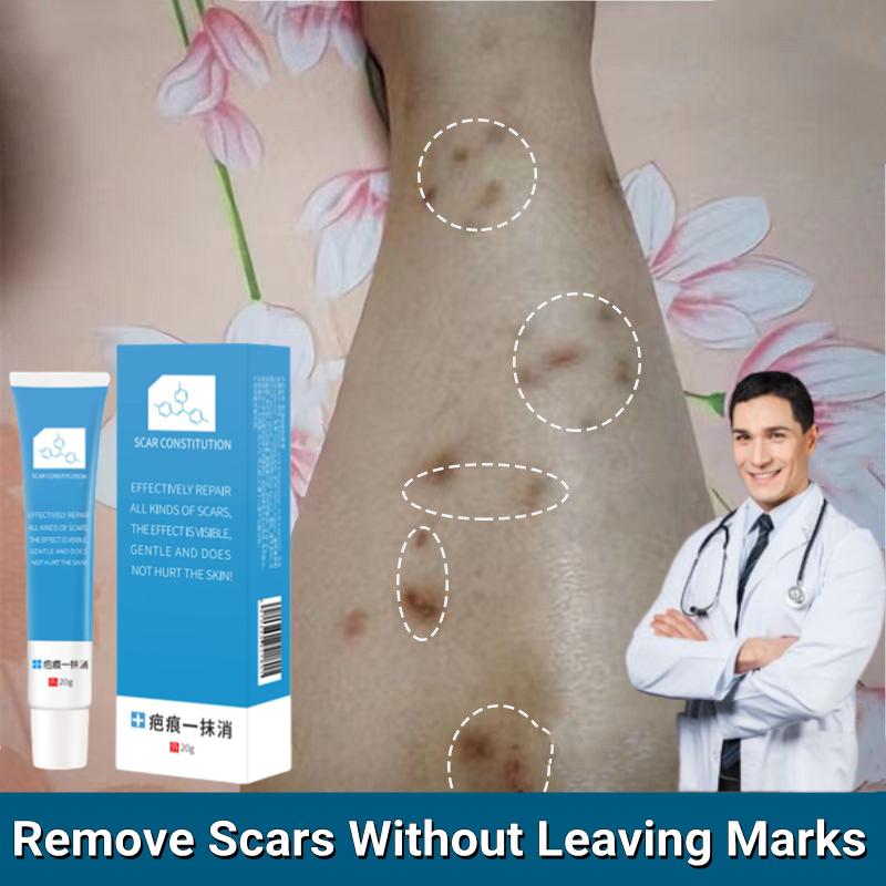 Product Introduction of Kem Loại Bỏ Sẹo, Để Phục Hồi Sẹo Thâm, Loại Bỏ Sẹo Rỗ, Loại Bỏ Vết Co Giãn 25