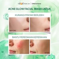 Gambar HNH Skincare - Facial Wash Acne 100ml - Sabun Muka Jerawat Gentle Cleanser untuk Kulit Berminyak & Acne Prone - Oily - Acne dari H&H Skincare Kota Administrasi Jakarta Selatan 5 Tokopedia