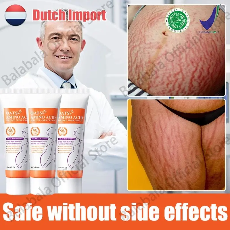 Stretch Mark Cream Scar Cream Pregnancy Cream Maternity Cream Scar Removal Repair Cream Repairs Firming Skin Halal and Natural Skincare for Pregnancy