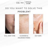 Gambar LKCARE Milk Cleanser Niacinamide 100gr | Facial Cleanser BPOM | Pembersih Wajah dengan Niacinamide | Skincare Aman untuk Kulit Sensitif & Kering | Membersihkan Makeup, Debu & Minyak | Menjaga Skin Barrier, Melembapkan & Mencerahkan Kulit dari lkcareofficial Kota Bogor 4 Tokopedia