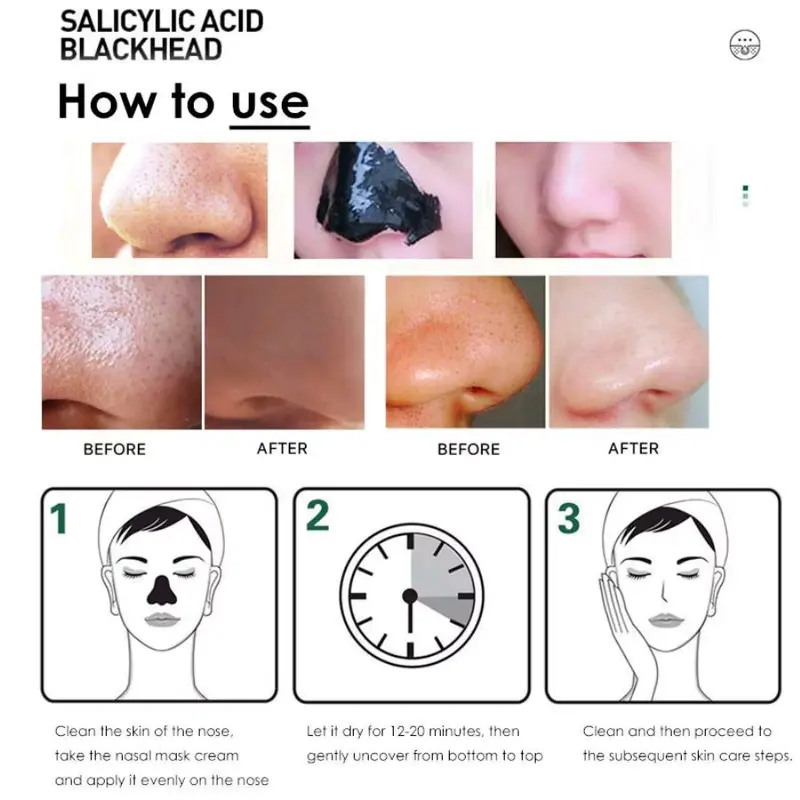 ZOOSON Masker Penghilang Komedo Hidung Blackhead Remover Wajah 6