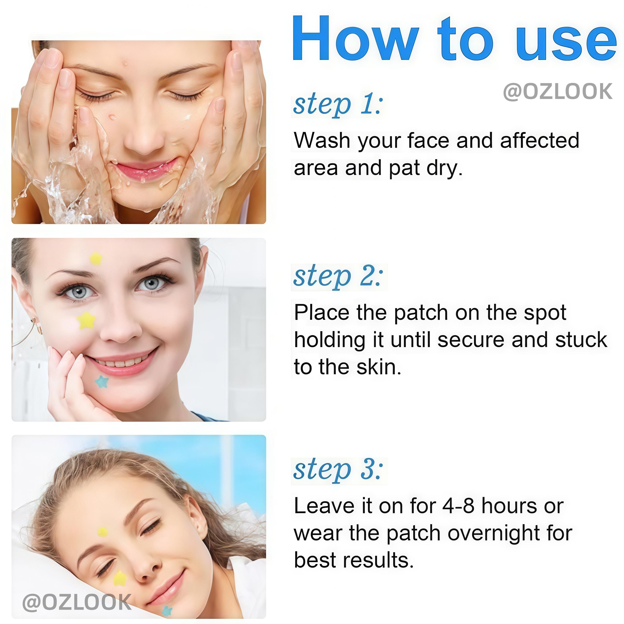 Jerawat Karakter Lucu Isi 160 Pcs Acne Pimple Patch Mengobati Mengangkat Isi Jerawat Dengan Desain Bintang Warna-warni