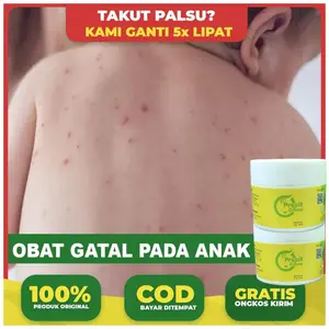 Procit Cream - Obat Salep untuk Ruam, Gatal, Biang Keringat, Keringat Buntet, Kutu Air & Alergi Kulit, Aman untuk Anak