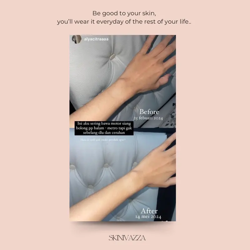 SKINIVAZZA - Salmon-DNA Extra Chromabright Whitening Lotion 7