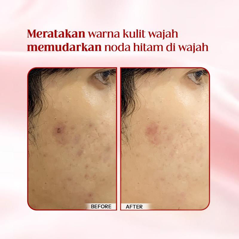 LITTLE FAIRY Secret Wish Radiance Serum Niacinamide Brightening hitam Essence  30mI 3