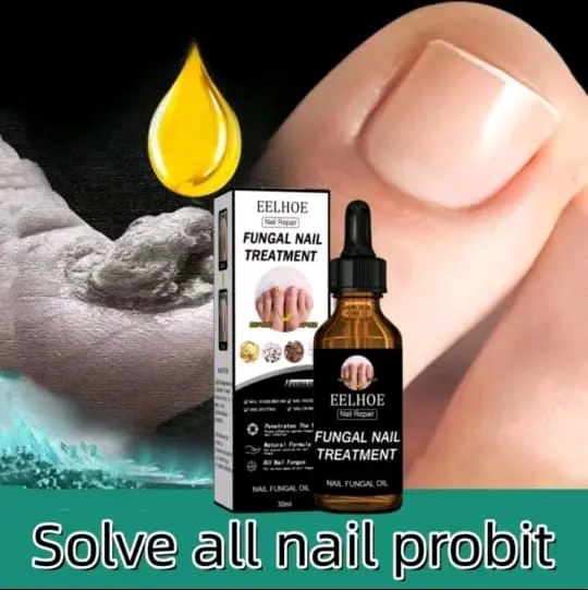 EELHOE untuk jamur kuku nail care anti jamur/perawatan kuku/perbaikan kuku Treatment