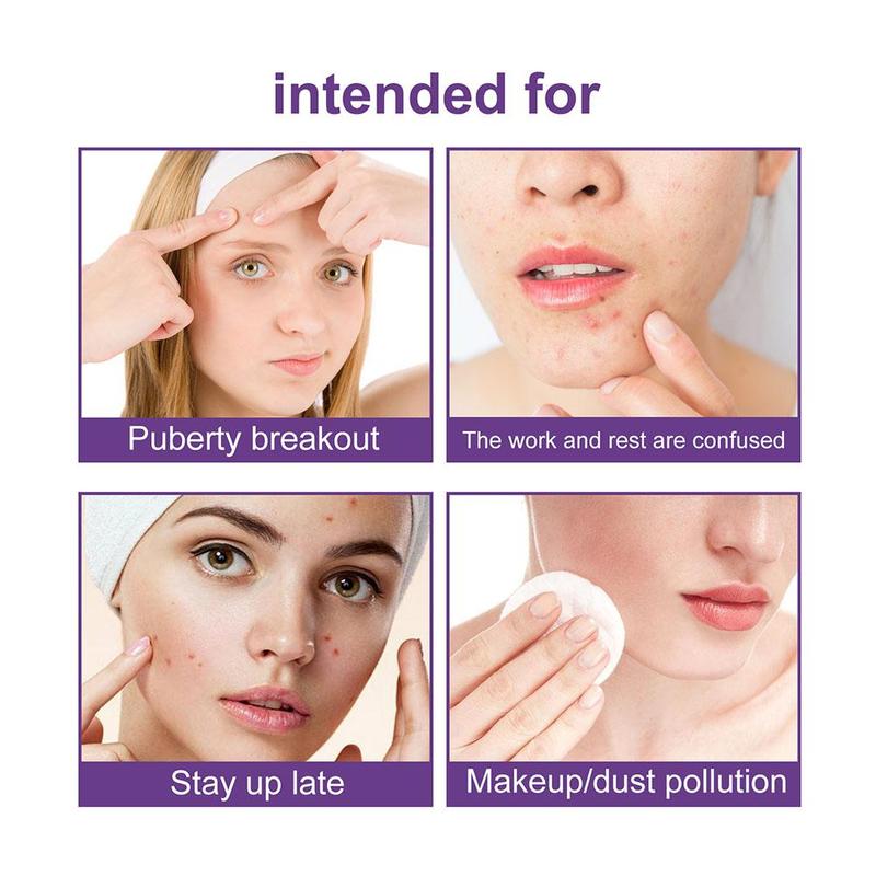 Product Introduction of 180pcs/box Hydrocolloid Acne Patch Pimple Repair Patch Ance Colorful Starry Care Face Sky L7K7 33