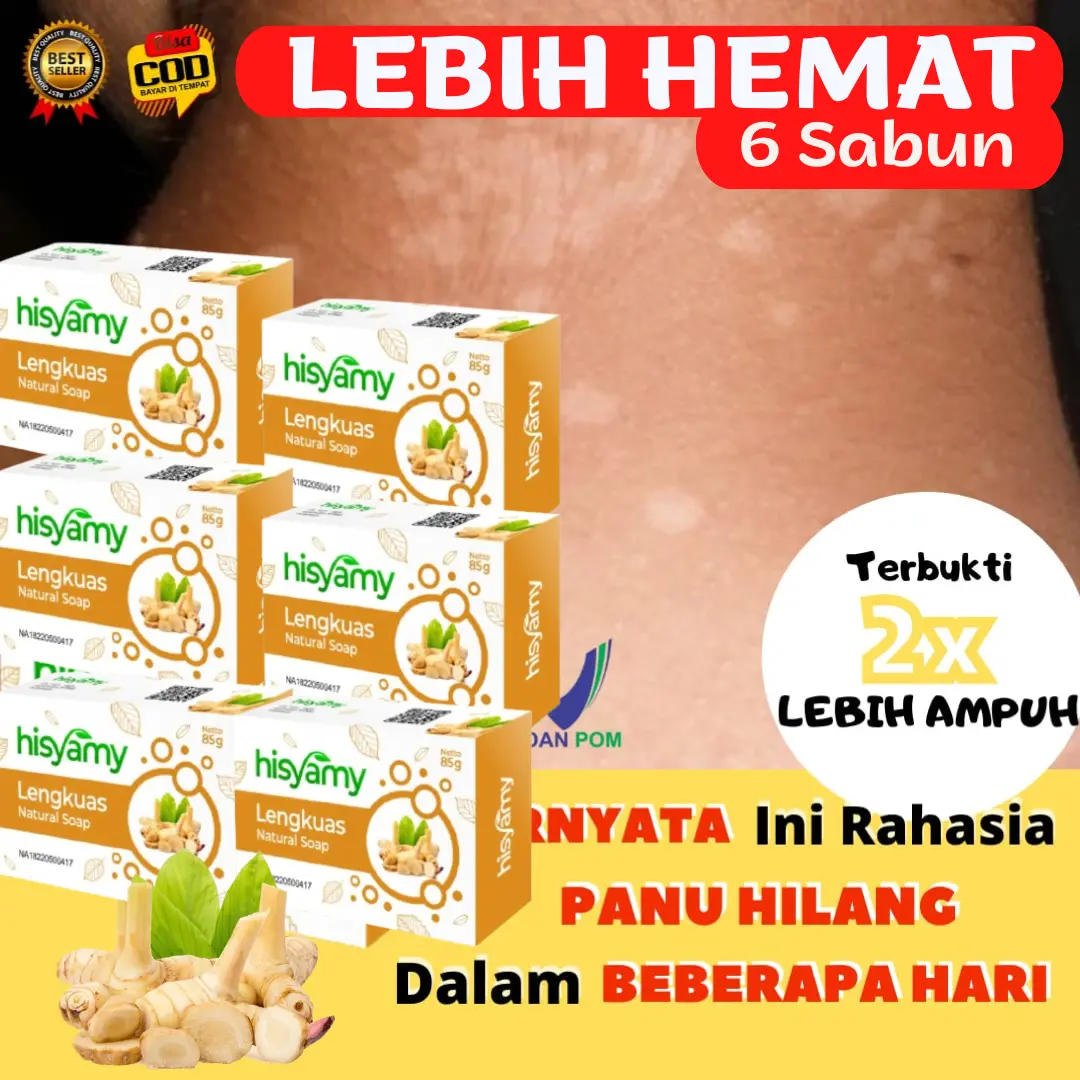 [BPOM] 6PCS Lebih Hemat Sabun Panu Paling Ampuh Lengkuas Herbal BPOM Hisyamy Penghilang Jamur Kadas Kurap Eksim Bisul Jerawat Gatal Gatel Bayi Anak Kulit Original 100% COD 85 gram Sabun Mandi Batang Selangkangan Hitam Mencerahkan Memutihkan