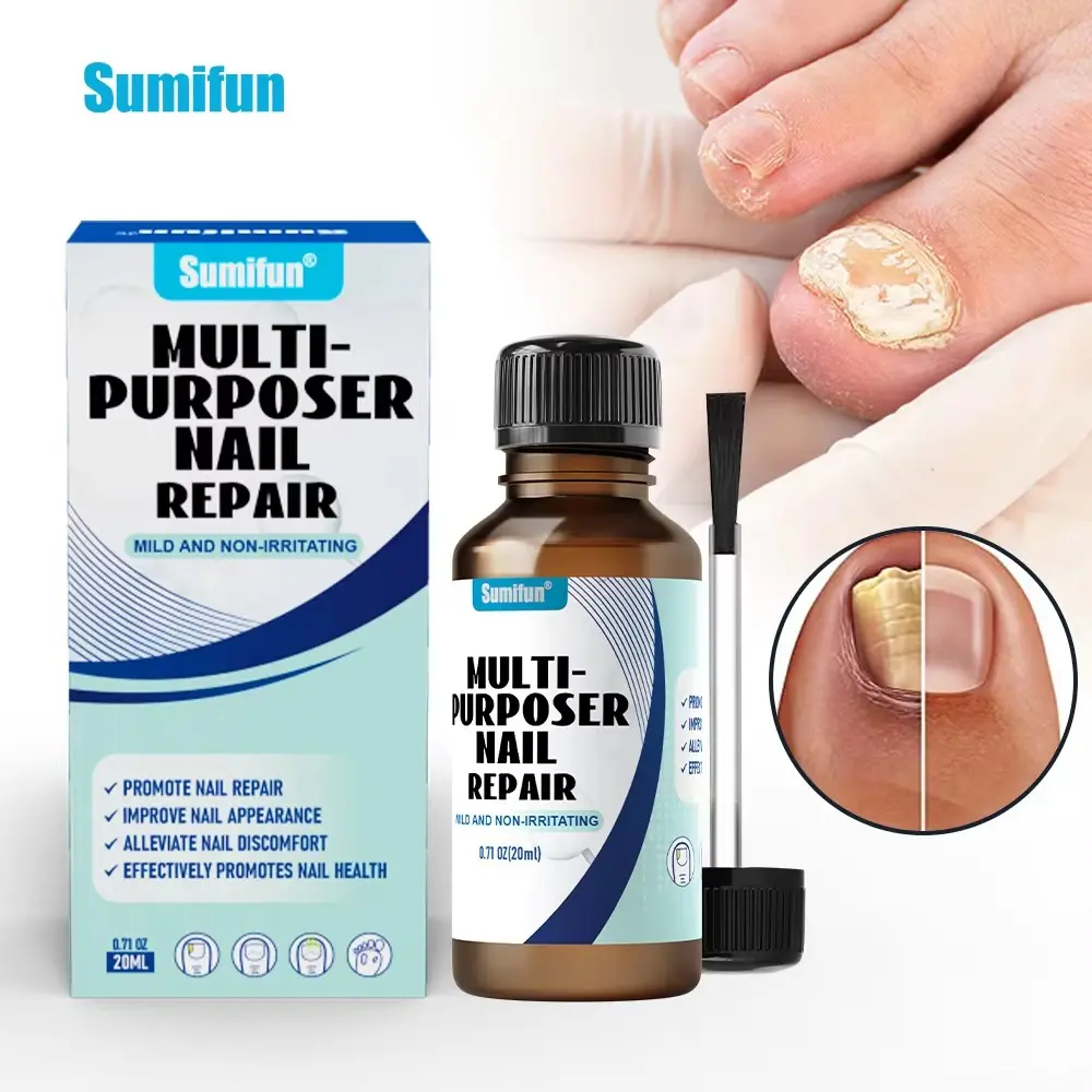 Sumifun Nail Repair 20ml Obat Kuku Rusak & Jamur Kaki Salep Pembaikan Kuku Sehat Dengan Ginseng Solusi Efektif untuk Kerusakan Kuku