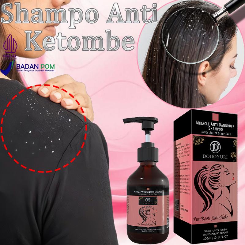 Shampoo anti ketombe Sampo anti ketombe Shampoo anti rontok Penghilang