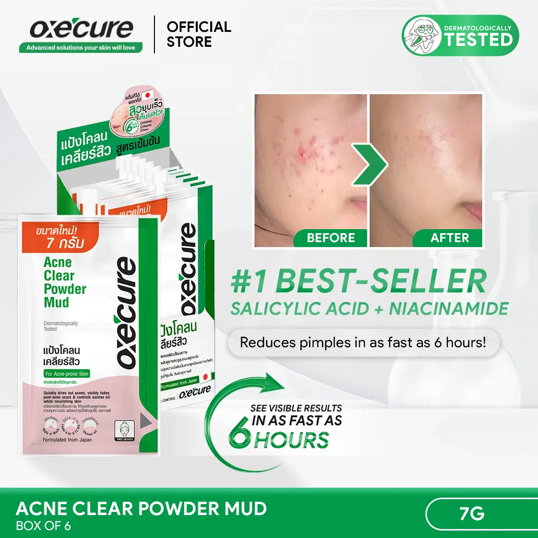 [BOX OF 6] OXECURE 2% Salicylic Acid Acne Clear Powder Mud [Pimples, blackheads, whiteheads clearing spot treatment & face mask; Fades dark marks and dark spots; For acne-prone skin] [Skin Repair Skincare]