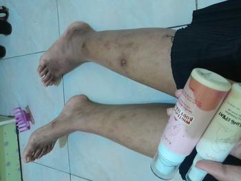 Product Review of ESASKIN (Paket) Peeling Spray dan Body Serum - Spesial Kulit Belang Mencerahkan Tubuh Serum Badan Kaki tangan from s**k 0
