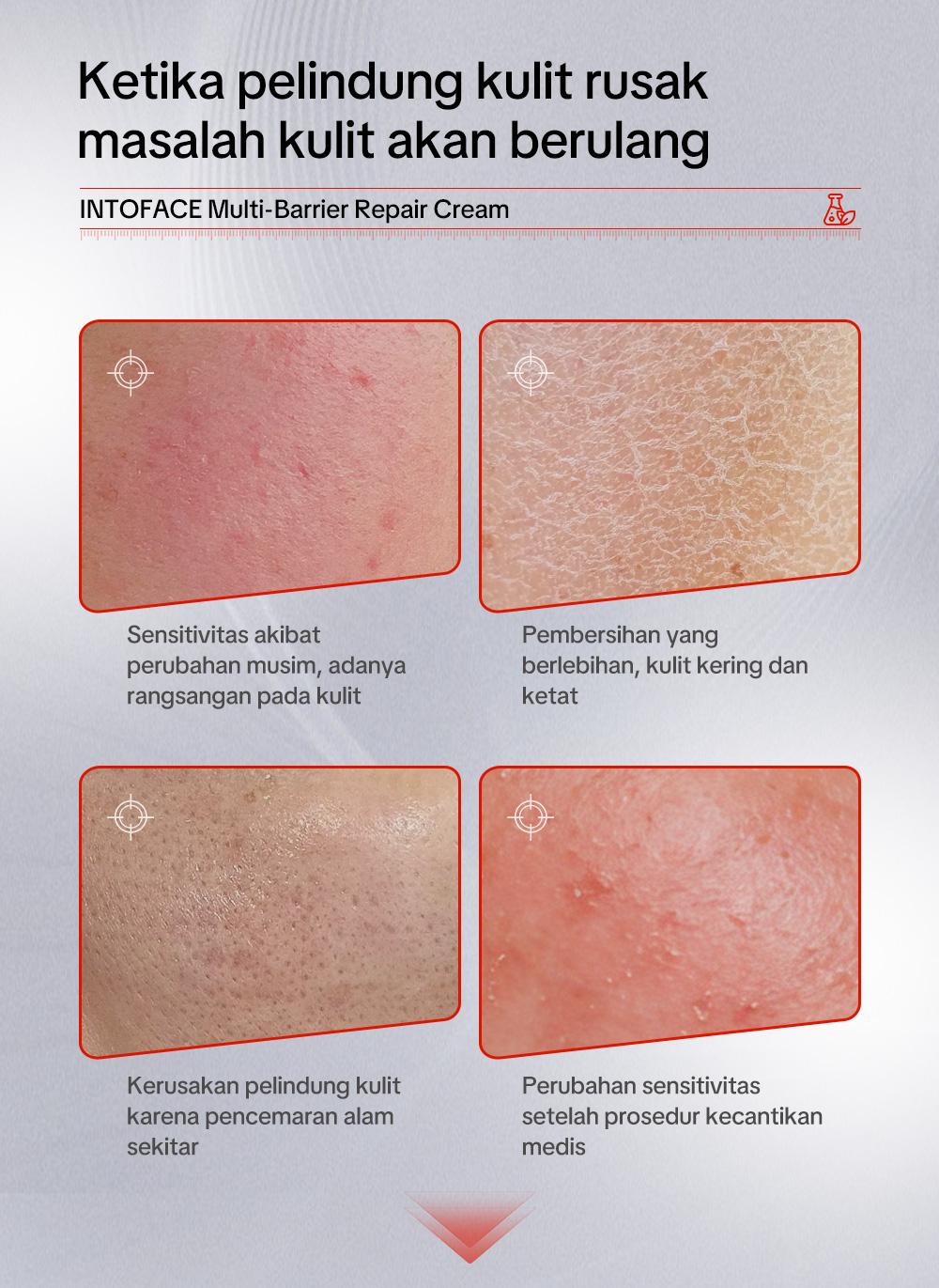 INTOFACE Multi-Barrier Repair Cream｜Atasi Kulit Kering & Sensitif ｜Redakan Kemerahan & Gatal Instan｜Hypoallergenic & 0% Iritasi Wajah Facial