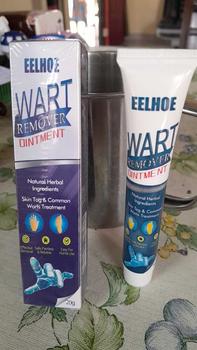 Product Review of Penghilang Kutil Wart Remover Skin Tag Remover Penghilang Tahi lalat Salep Penghilang Flek Hitam Perawatan from M** B**m 0