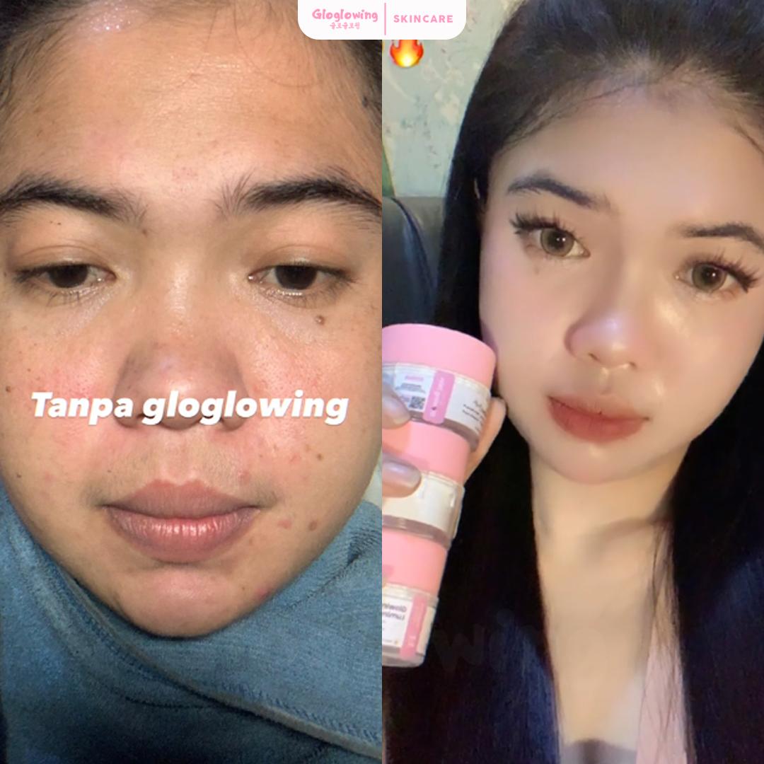 DOSIS 2 - Paket Retinol Booster Cysteamine / Antioxidant DOSIS 2 - Paket Retinol Booster Cysteamine / Antioxidant