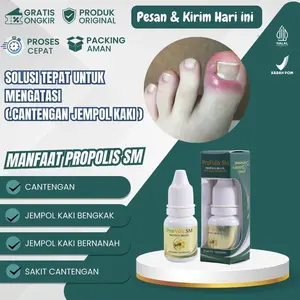 Propolis SM untuk Kuku Cantengan Jempol Kaki Bengkak Nyeri Bernanah Bau