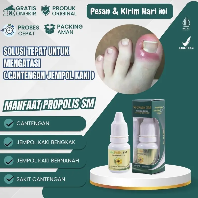 Propolis SM untuk Kuku Cantengan Jempol Kaki Bengkak Nyeri Bernanah Bau 0