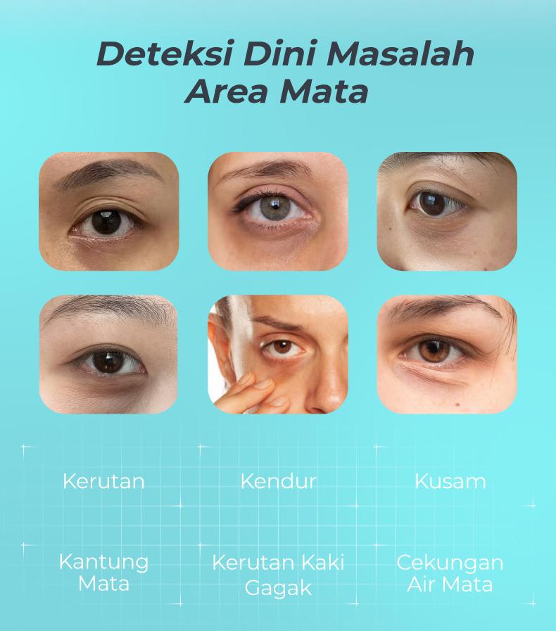 Eye Patch Anti Puffy Eyes untuk Mata Bengkak | Kurangi Tampilan Kantung Mata | Caffeine + Ginseng + Ectoin + Centella (7 Pairs) Eye Patch Anti Puffy Eyes untuk Mata Bengkak | Kurangi Tampilan Kantung Mata | Caffeine + Ginseng + Ectoin + Centella (7 Pairs)