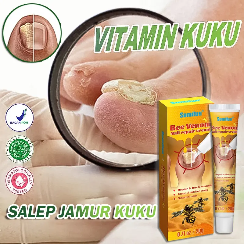 Salep Jamur Kuku 20g Rusak Perawatan Kuku Obat Jamur Kuku Obat cantengan jempol kaki Perawatan Jamur Kuku Paronychia