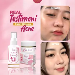 WSP ACNE DAN Glow BPOM ORIGINAL Skincare  kemasan baru  Berjerawat Mencerahkan Berminyak