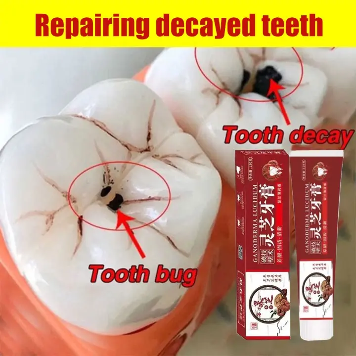 Ganoderma Lucidum Toothpaste - Whitening Power & Antibacterial | Anti Plak & Gigi Sensitif | Perlindungan Gusi 12 Jam | Ekstrak Jamur Lingzhi | Fresh Breath & Anti Karies 1