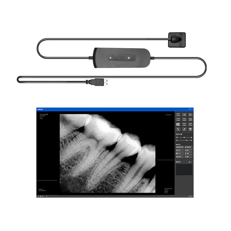 Dentistry Digital Cameras Sensor X-Ray High-Frequency Rx Digital - Shop ...