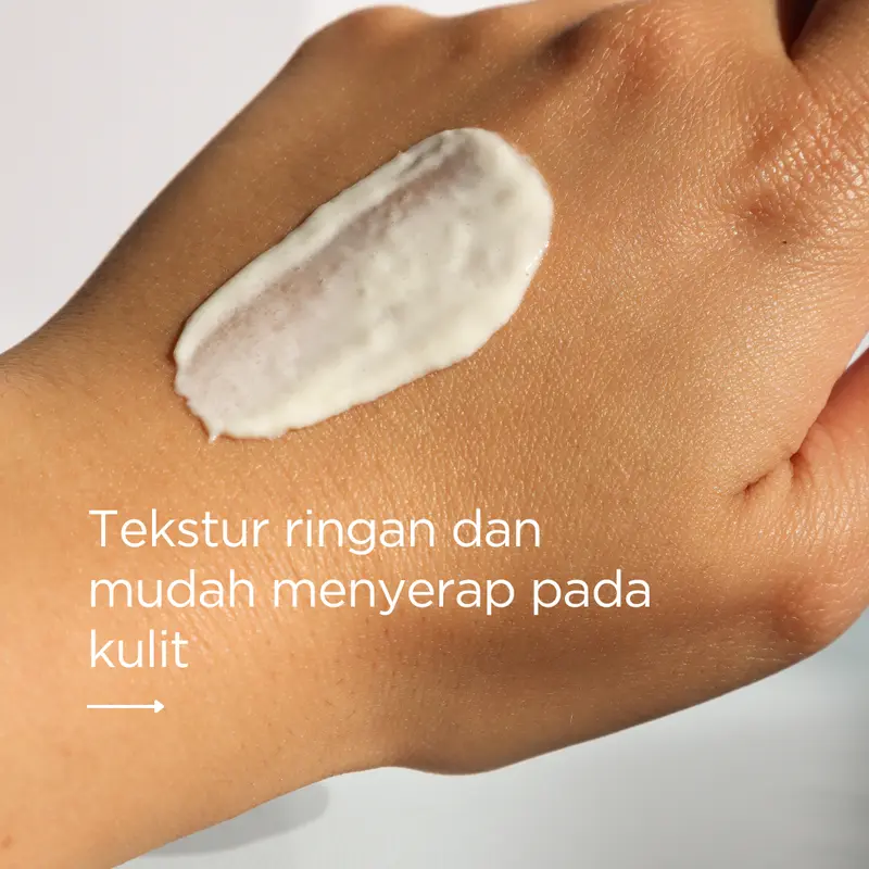 [100% Original] Cindynal Niacinamide Cream, Remove Freckles & Dark Spot | Penghilang Flek dan Bintik Hitam, Memudarkan Bekas Jerawat 4
