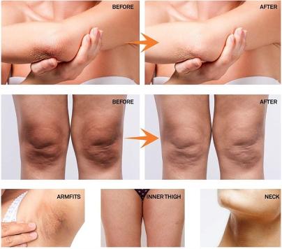 Whitening Cream  pemutih ketiak hitam krim ketiak selangkangan Underarm Cream Whitening Krim Cream Pemutih  Badan Ketiak Leher Pantat dan Selangkangan Sangat  50g sabun  pemutih 6