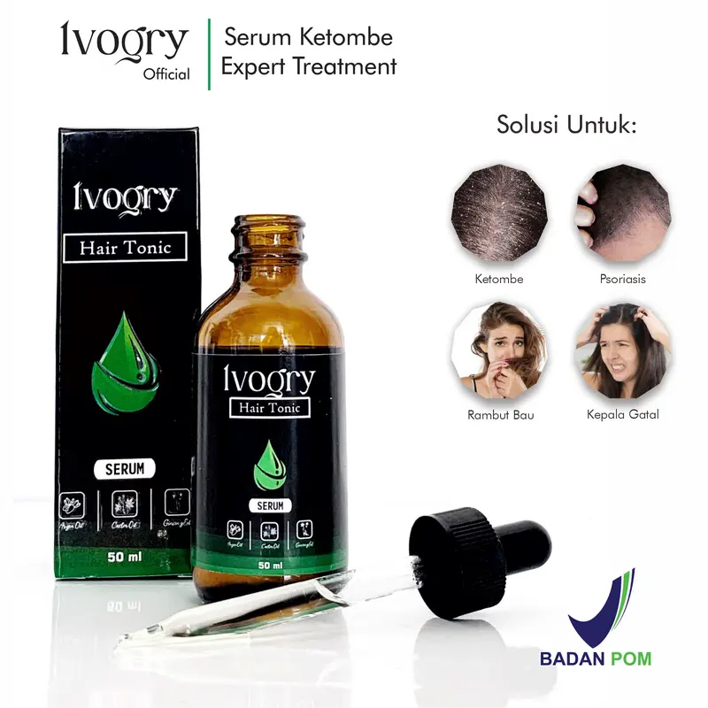 [BUNDLING 2 HEMAT] Ivogry Serum Anti Ketombe | Hair Serum Tonic Anti Dandruff Expert Treatment 50ml | Bergaransi  Ketombe Hilang Gatal Kering Perempuan Laki-Laki Haircare Tetes Psoriasis 2
