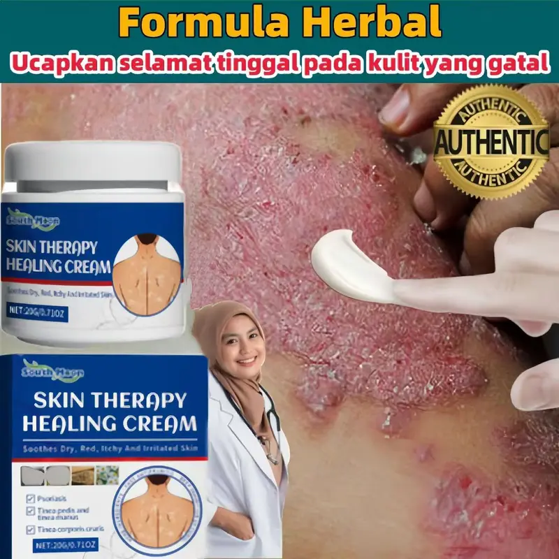 South Moon Salep Khusus Psoriasis - psoriasis ointment - Kurap Pada Kulit Kepala - Kutu Air - Kurap Pada Badan - Eksim - Infeksi Kulit - Obat Luar Mengatasi Gatal 20g Perawatan Tubuh Kering Pembersihan 1