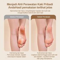 Gambar Skylumba Penghalus Tumit Kaki Elektrik Waterproof Aman untuk Kaki Kapalan Pengikis Sel Kulit Mati Callus Remover Manicure Padicure with LED Lamp CR01 - Callus Remover CR01 - Black  dari Skylumba.id Kota Administrasi Jakarta Barat 4 Tokopedia