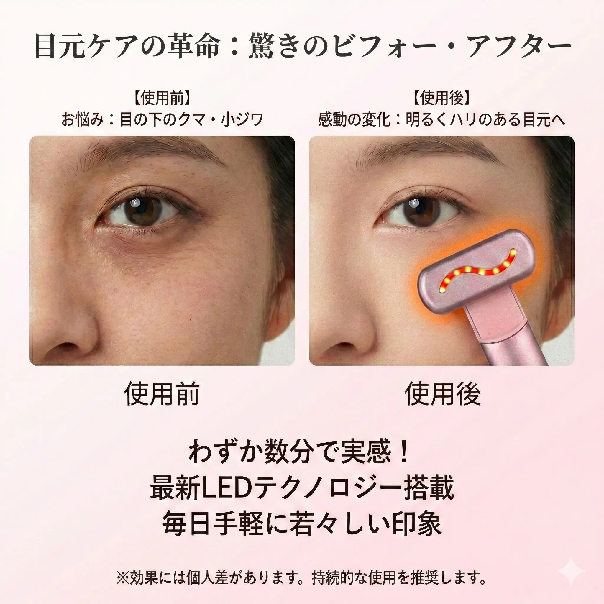 美容器OndineBEAUTYSHAPE AXXZIA Mate For Eyes – Beauty Ninja