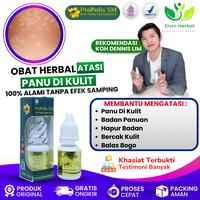 Gambar Suplemen Penghilang Panu, Panu Agar Cepat Hilang, Panu Seluruh Badan, Panu Di Wajah, Penghilang Jamur Kulit,  hapur Menahun, Kadas Kurap, Kulit Hapuran, Panu di Leher, Panu Di Punggung, Panu Di Seluruh Tubuh Dengan ProPolis SM dari Elvin Herbal Kota Administrasi Jakarta Pusat 1 Tokopedia