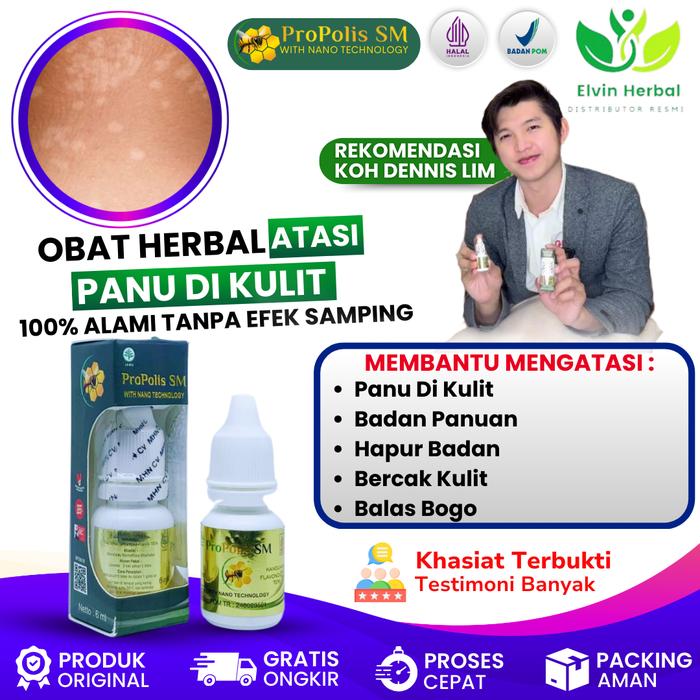 Gambar Suplemen Penghilang Panu, Panu Agar Cepat Hilang, Panu Seluruh Badan, Panu Di Wajah, Penghilang Jamur Kulit,  hapur Menahun, Kadas Kurap, Kulit Hapuran, Panu di Leher, Panu Di Punggung, Panu Di Seluruh Tubuh Dengan ProPolis SM dari Elvin Herbal Kota Administrasi Jakarta Pusat Tokopedia