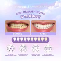 Gambar Moeloet Whitening Purple Strips – 5 Hari (Isi 1 Box / 5 Strip) dari Moeloet_NEW Kota Bandung 3 Tokopedia