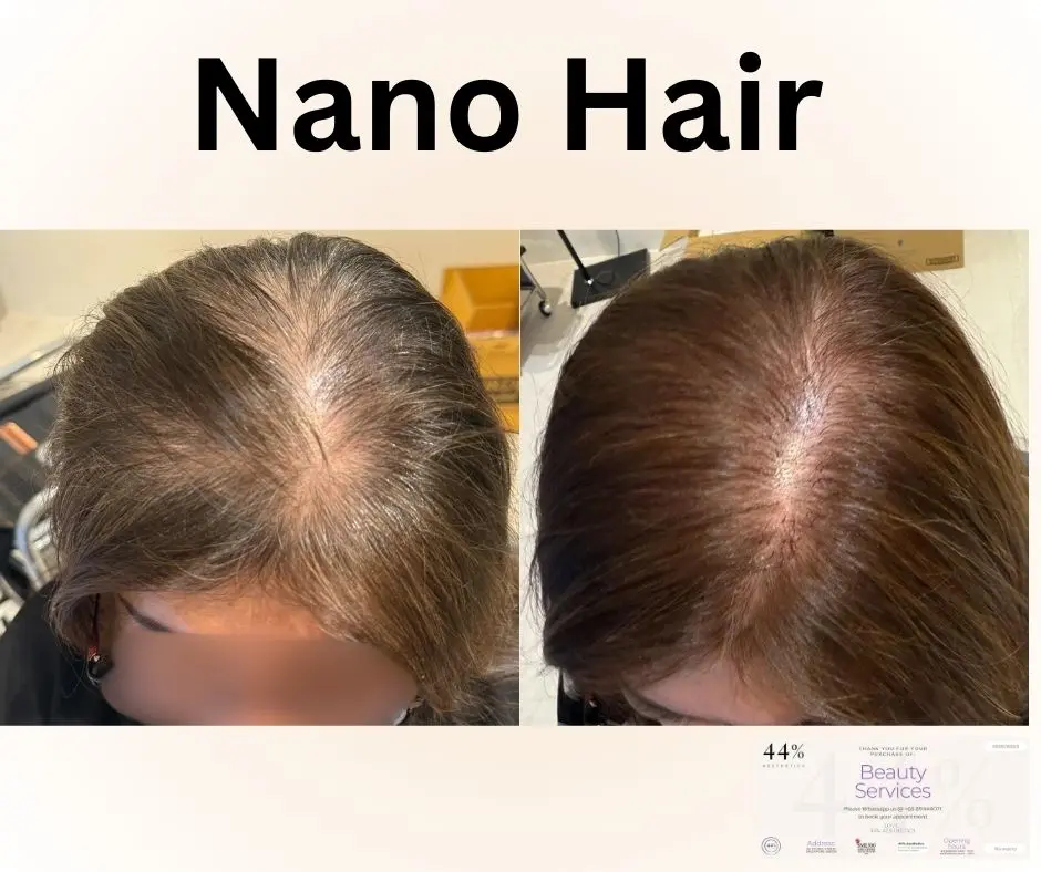 [PHYSICAL VOUCHER] 44% Aesthetics - NANO Hair