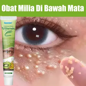 krim penghilang milia syringoma xanthelasma butiran lemak sekitar mata 20g Penghilang Milia Kutil di bawah Mata Eye Milia Remover