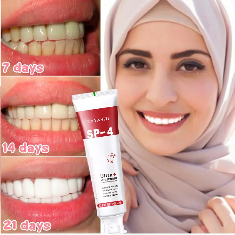 Toothpaste Whitening Toothpaste Remove Yellow Teeth Fresh Breath 120g sp-4 probiotic toothpaste Remove tartar yellow stone plaque Anti decay oral care