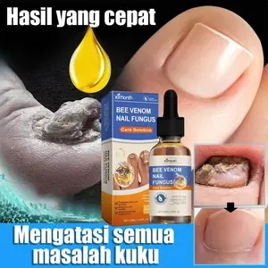 Nail Treatment Feet Care Essence Nail Foot Whitening Toe Nail Fungus Removal Gel Anti Infection Paronychia Onychomycosis Obat Kuku Rusak  obat Kuku Berjamur  obat Jamur Kuku