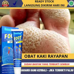 Obat Telapak Kaki Rayapan, Obat Kaki Rayapan, Obat Telapak kaki Bolong Bolong, Salep Kaki Rayapan Dan Bau, Obat Telapak Kaki Bau, Obat Jamur di Kaki, Obat Kaki Pecah Kering, Obat Telapak Kaki Bolong Berlubang Dengan Propolis