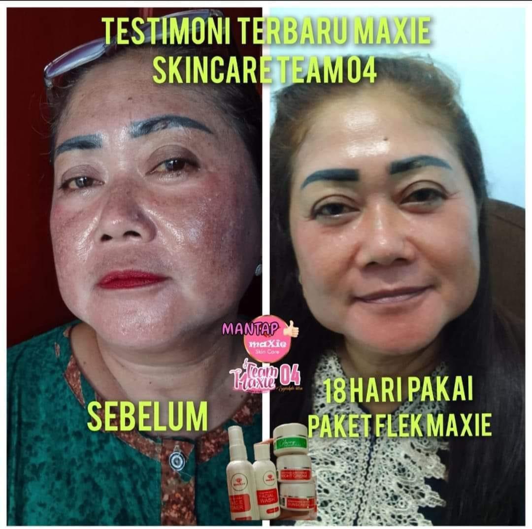 Maxie Skincare BPOM Agen Resmi ORIGINAL (free GIFT)