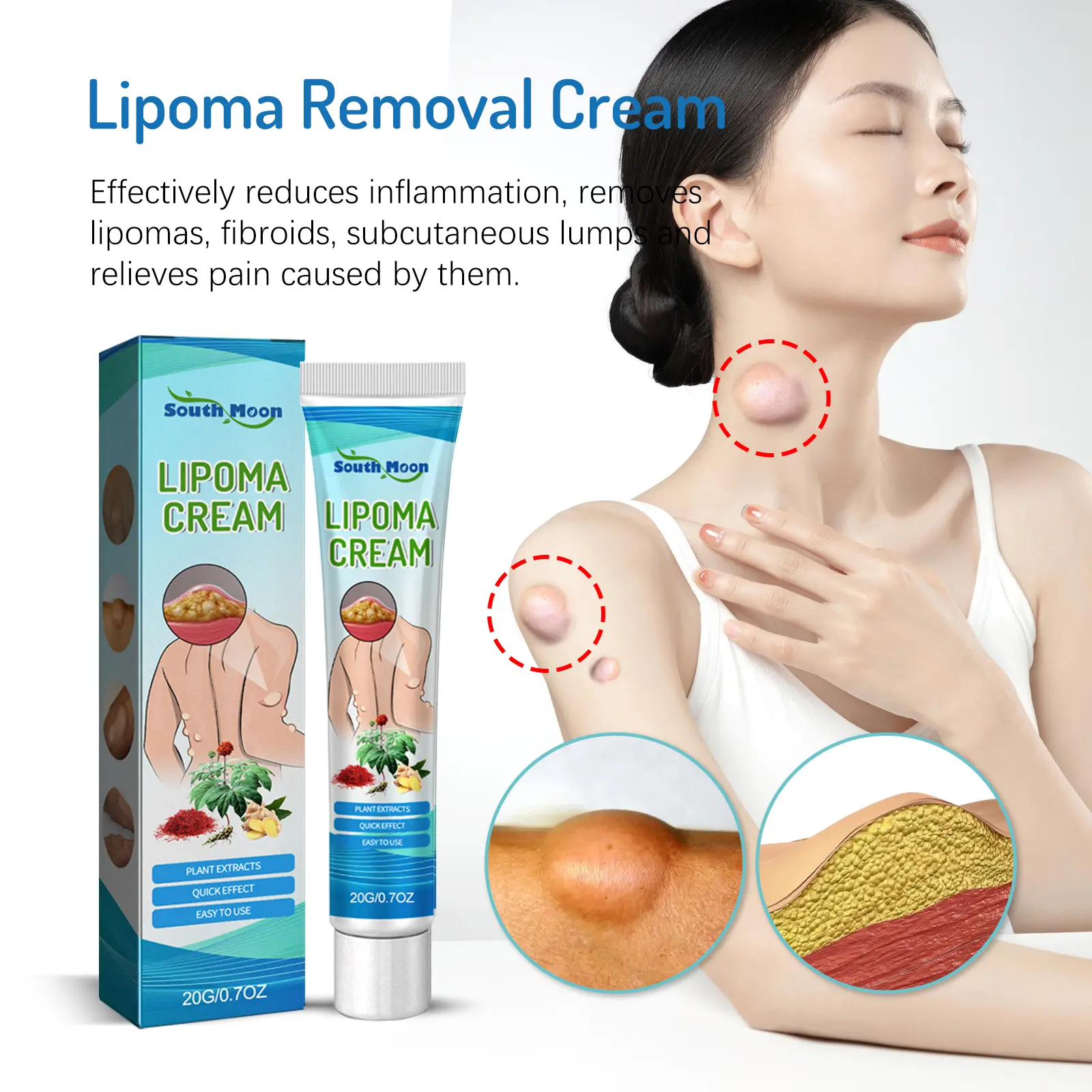 Lipoma Cream 20g Salep Lipoma Krim Obat Salep Benjolan Obat Lipoma Penghilang Benjolan Aman dan Tanpa Efek Samping Langsung Sembuh Total tanpa Meninggalkan Akar Ampuh Menghilangkan Benjolan Seluruh Tubuh