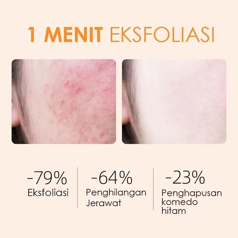 GMEELAN Orange Enzyme Peeling Gel 50g- Atasi Kulit Kasar, Kusam & Bekas Jerawat | Eksfoliasi Keratin Tebal + 7 Ekstrak Tanaman | Aman untuk Sensitif Wajah Melembutkan Komedo Exfoliating Perawatan Pencerah Pembersihan 2