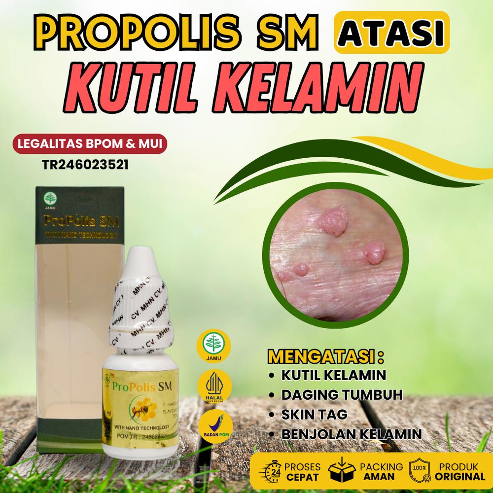 Propolis Sm - Atasi Kutil Kelamin Kutil Hpv Daging Tumbuh Area Kelamin Skin Tag Benjolan Kelamin Dengan Ekstrak Madu Alami Isi 6 Ml