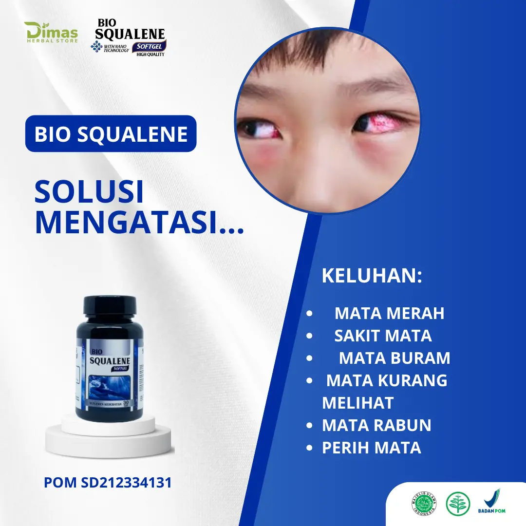 Bio Squalene Herbal Atasi Sakit Mata, Perih Mata, Mata Buram, Mata Rabun, Kulit Mata Memerah, Kurang Melihat, Mata Katarak, Minus Pada Mata, Infeksi Pada Mata, Gatal Dan Nyeri Pada Mata